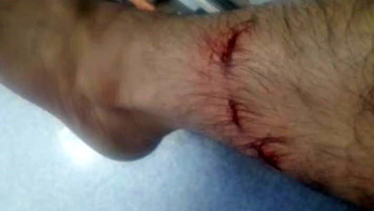 Başıboş köpeklerin saldırısına uğrayan vatandaş yetkililere seslendi