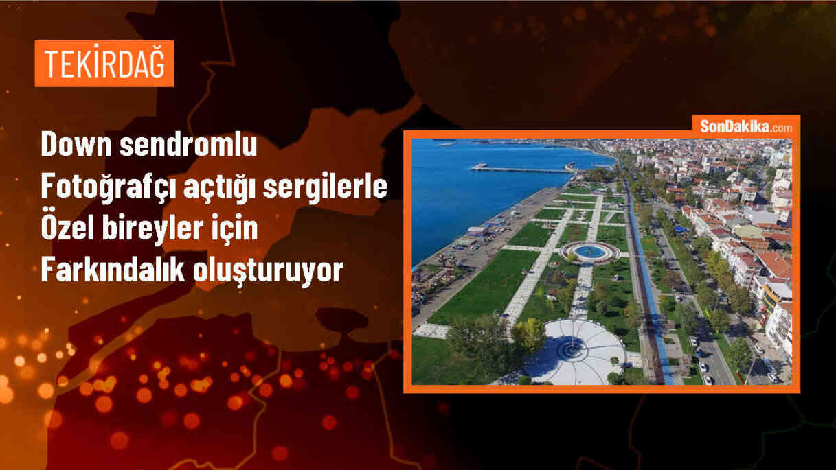 Down Sendromlu Genç, Fotoğraflarıyla Farkındalık Oluşturuyor
