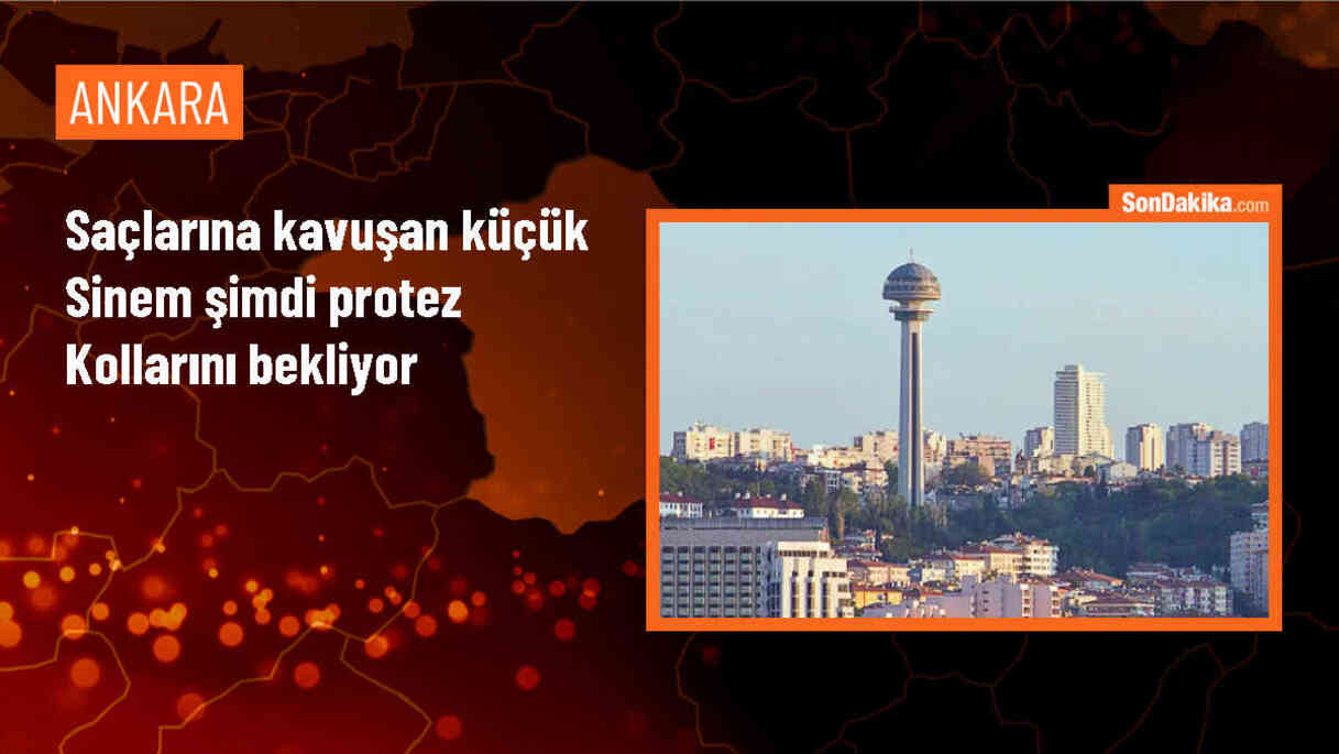 Konya\'da yangında kollarını kaybeden 9 yaşındaki Sinem, perukla hayalini gerçekleştirdi