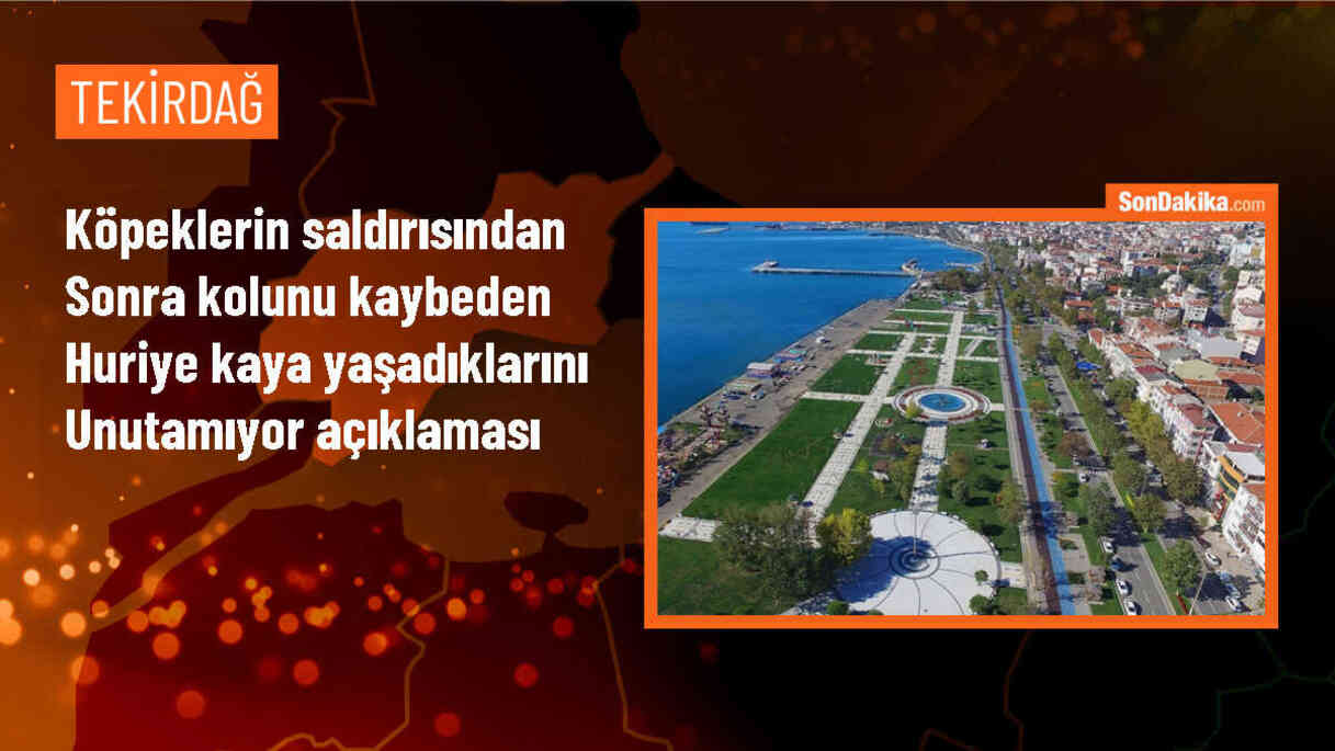 Köpek Saldırısında Kolunu Kaybeden Kadın: Travmalarım Sürüyor