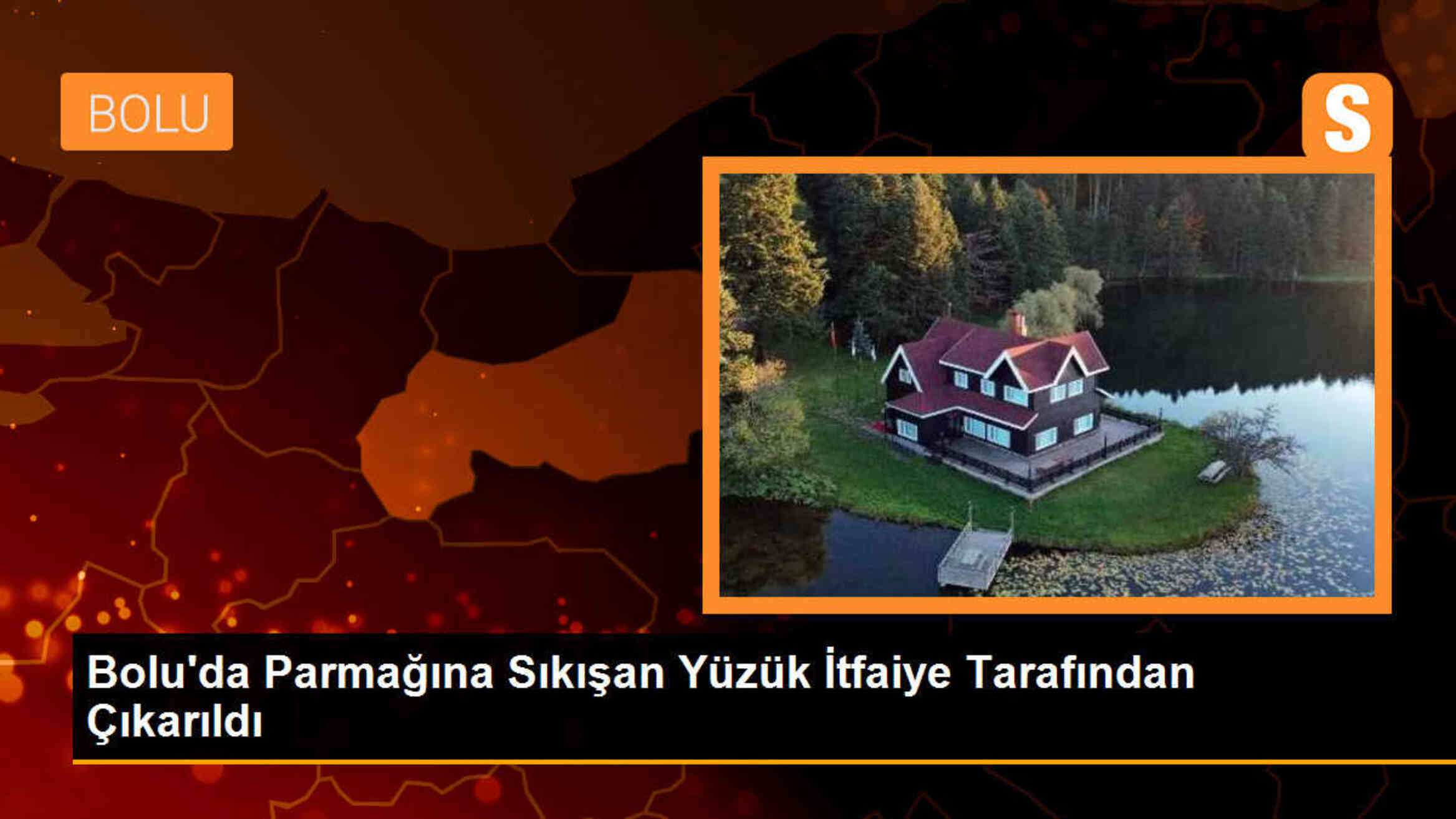 Bolu\'da parmağına sıkışan kadının yüzüğü itfaiye ekipleri tarafından çıkarıldı