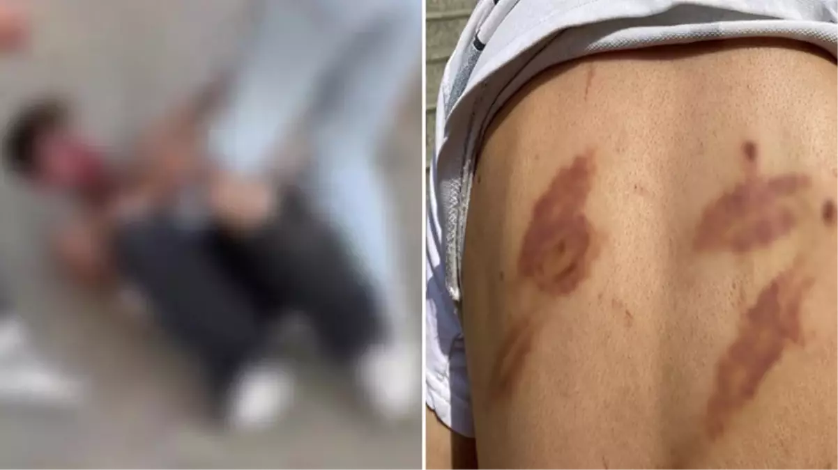 Eşini dövüyor iddiasıyla öldüresiye dövülen adamın karısından hayrete düşüren sözler