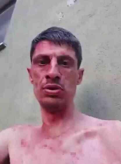 Canlı yayın açarak 'Namus belası' şarkısı eşliğinde eniştesini bıçakladı