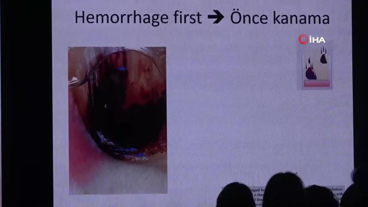 Ayrılık Nedeni Dişleri mi