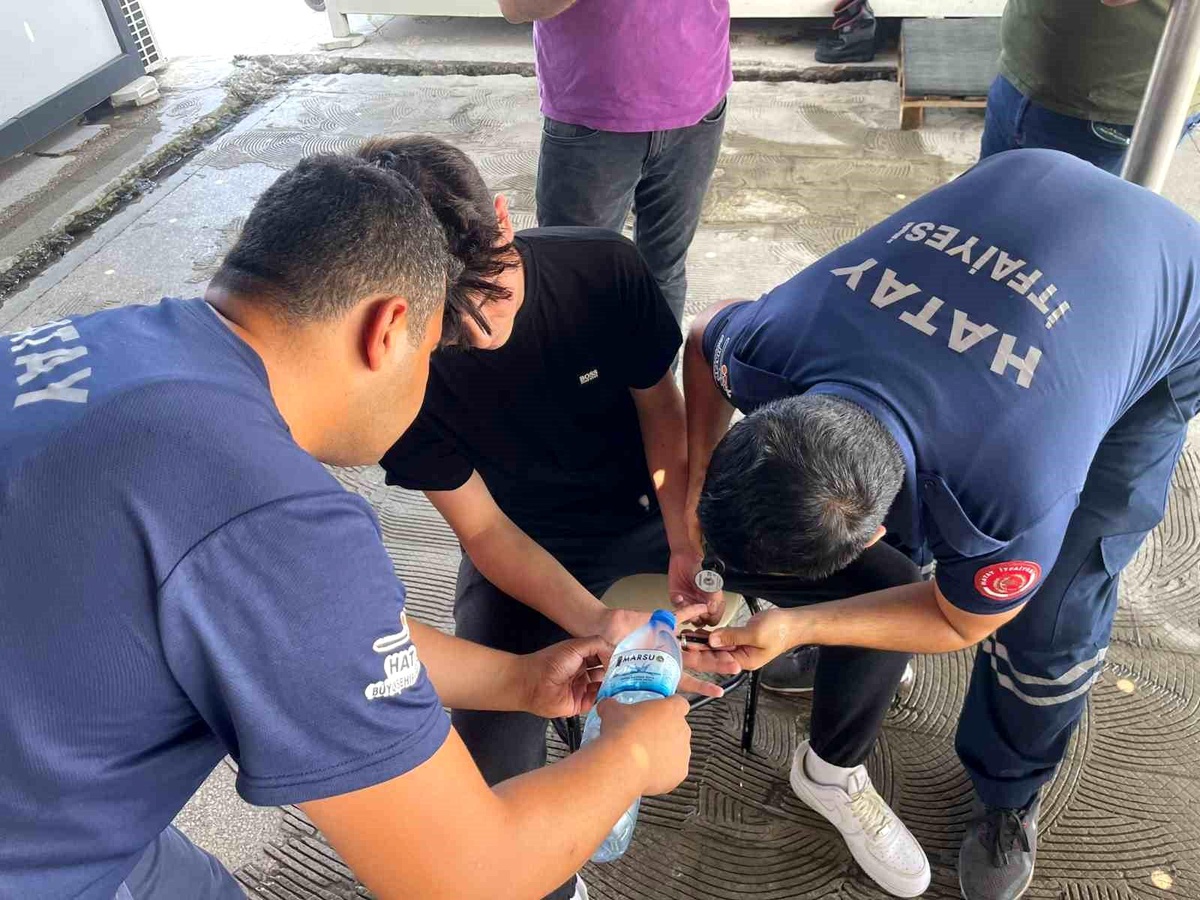 Hatay\'da Vatandaşın Parmaklarına Sıkışan Yüzük İtfaiye Tarafından Çıkartıldı