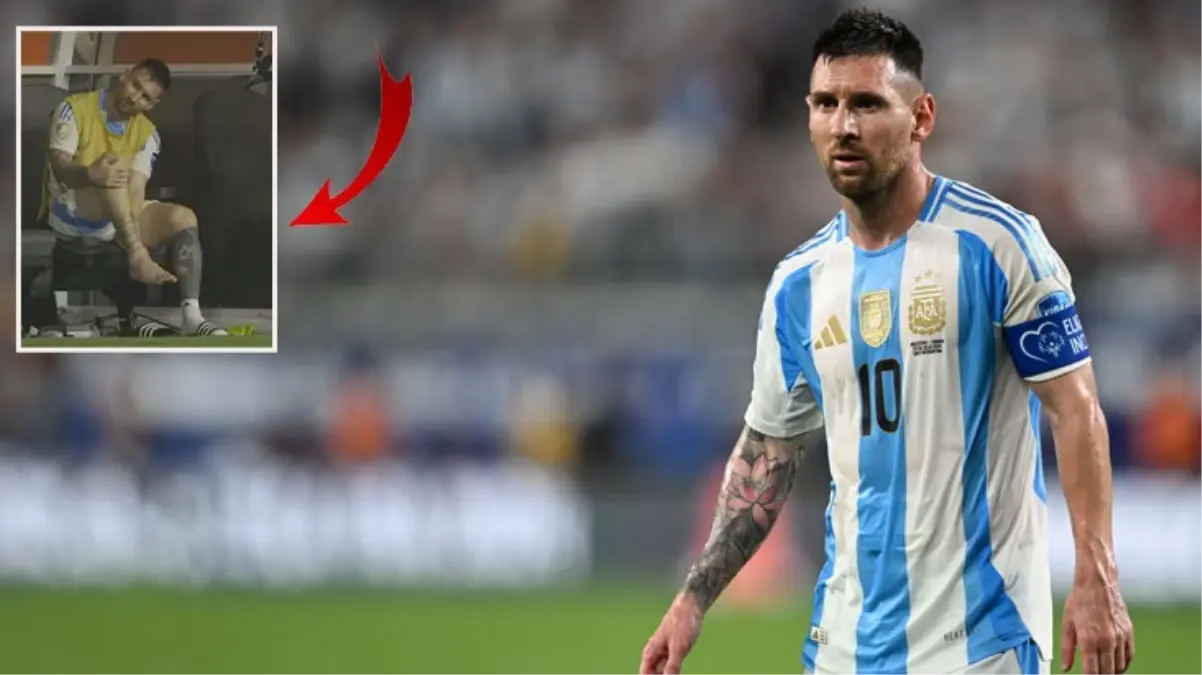 Maça devam edemedi! İşte Copa America finalinde sakatlanan Messi\'nin ayağının son hali