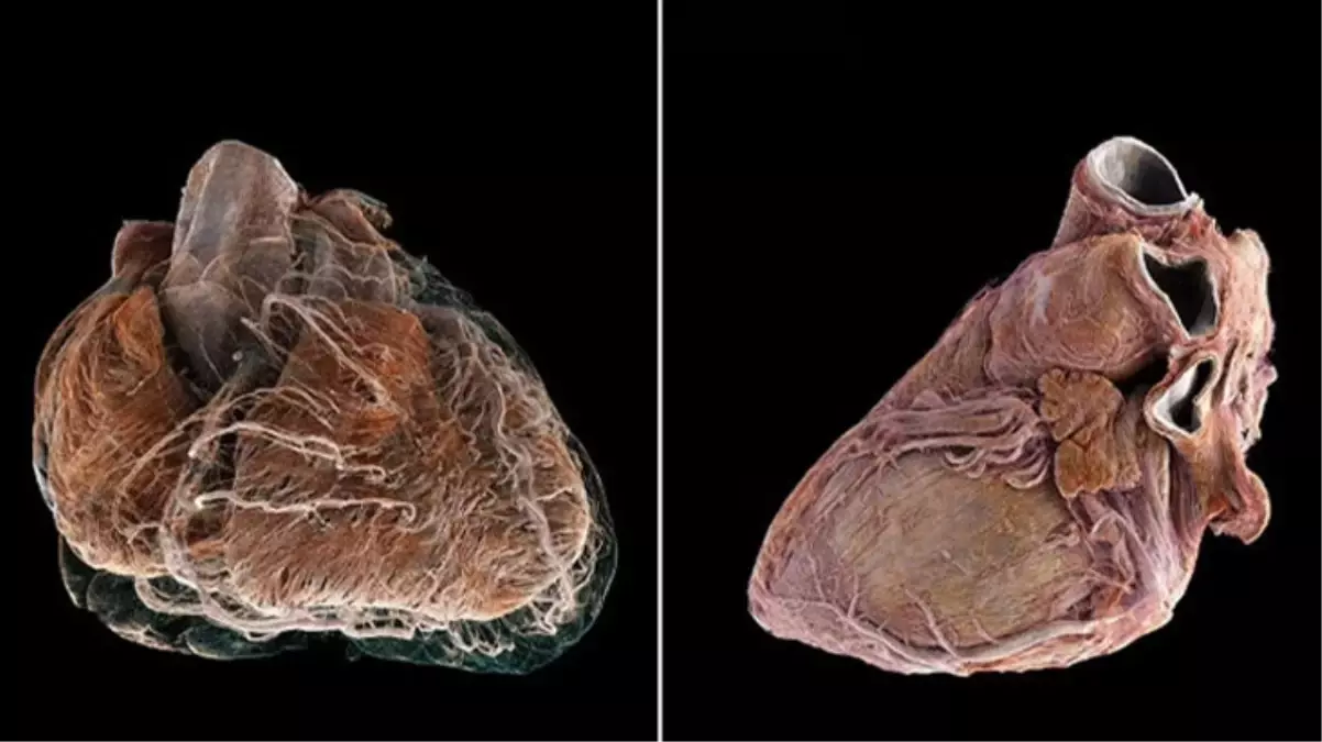 Bilim insanları, insan kalbinin iç yapısını ayrıntılı olarak gösteren, Google Earth\'e benzer yeni bir teknoloji geliştirdi