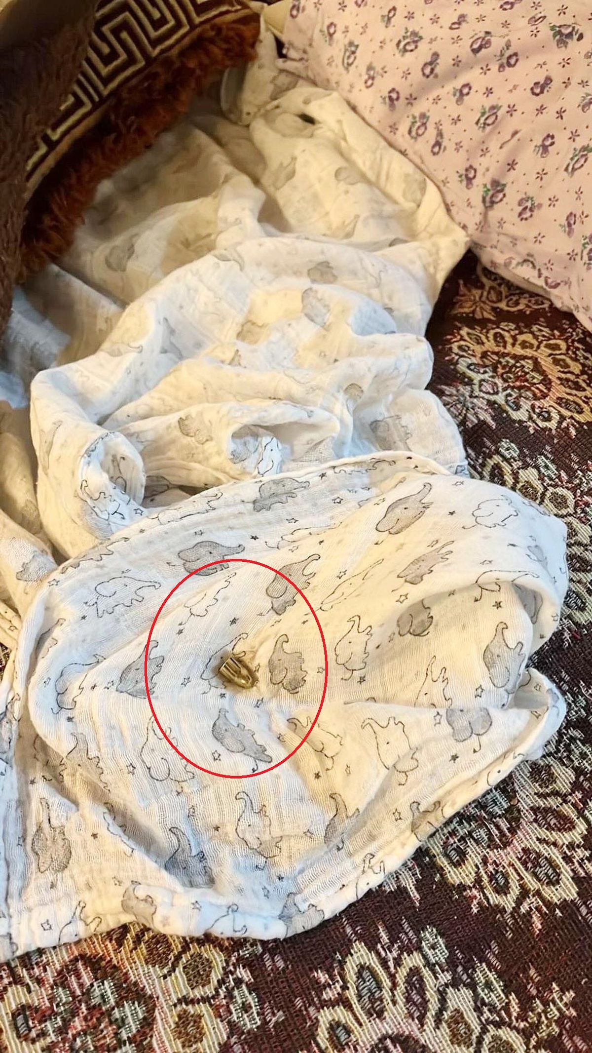 Hobi bahçesinde uyuyan bebek, çatıdan düşen mermiyle yaralandı