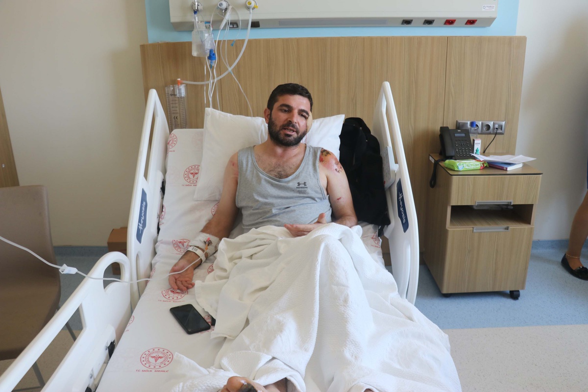 Kahramanmaraş\'ta Otomobilin Önüne Atladı, Yüzünden Yaralandı