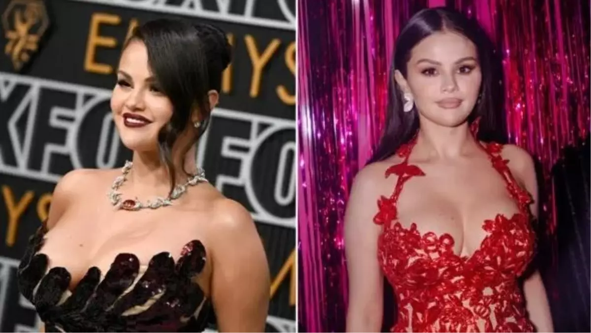 Selena Gomez, vücudu hakkında yorum yapan hayranlarını azarladı: \'Botoks Yaptırdım, Beni Rahat Bırakın\'