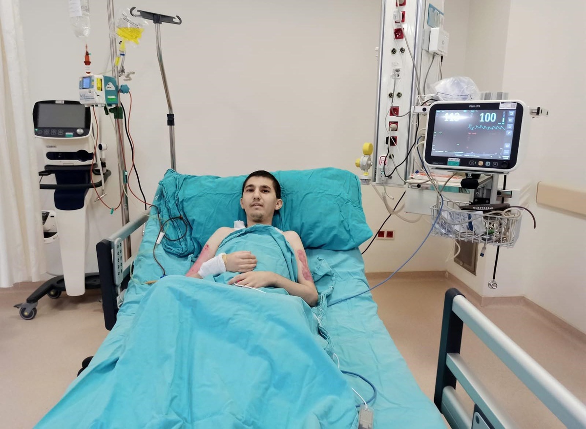 Üniversite öğrencisi yangında yüzde 40 yanıkla yaşama bağlandı