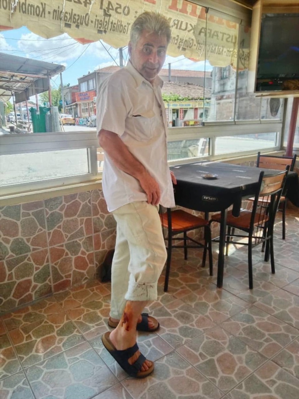 Çanakkale\'de sahipsiz köpeklerin saldırısında yaralanan kişi tedaviye alındı