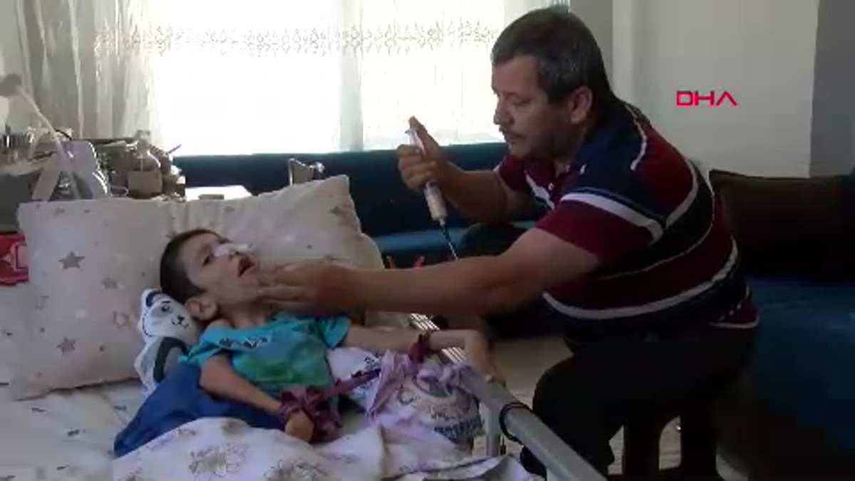 Hidrosefali Hastası Osmancan İlimsever, Hayata Burnundan Beslenerek Tutunuyor