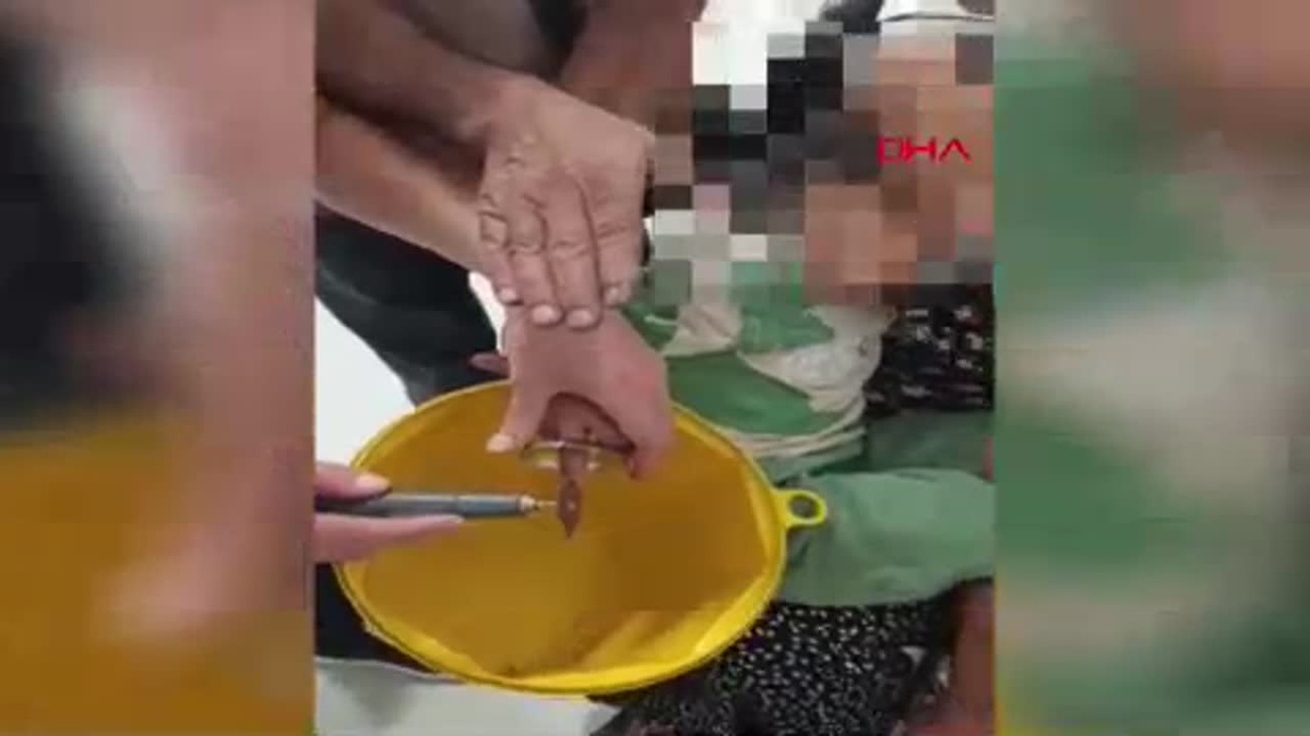 9 yaşındaki çocuğun parmağına sıkışan metal parça itfaiye tarafından çıkarıldı