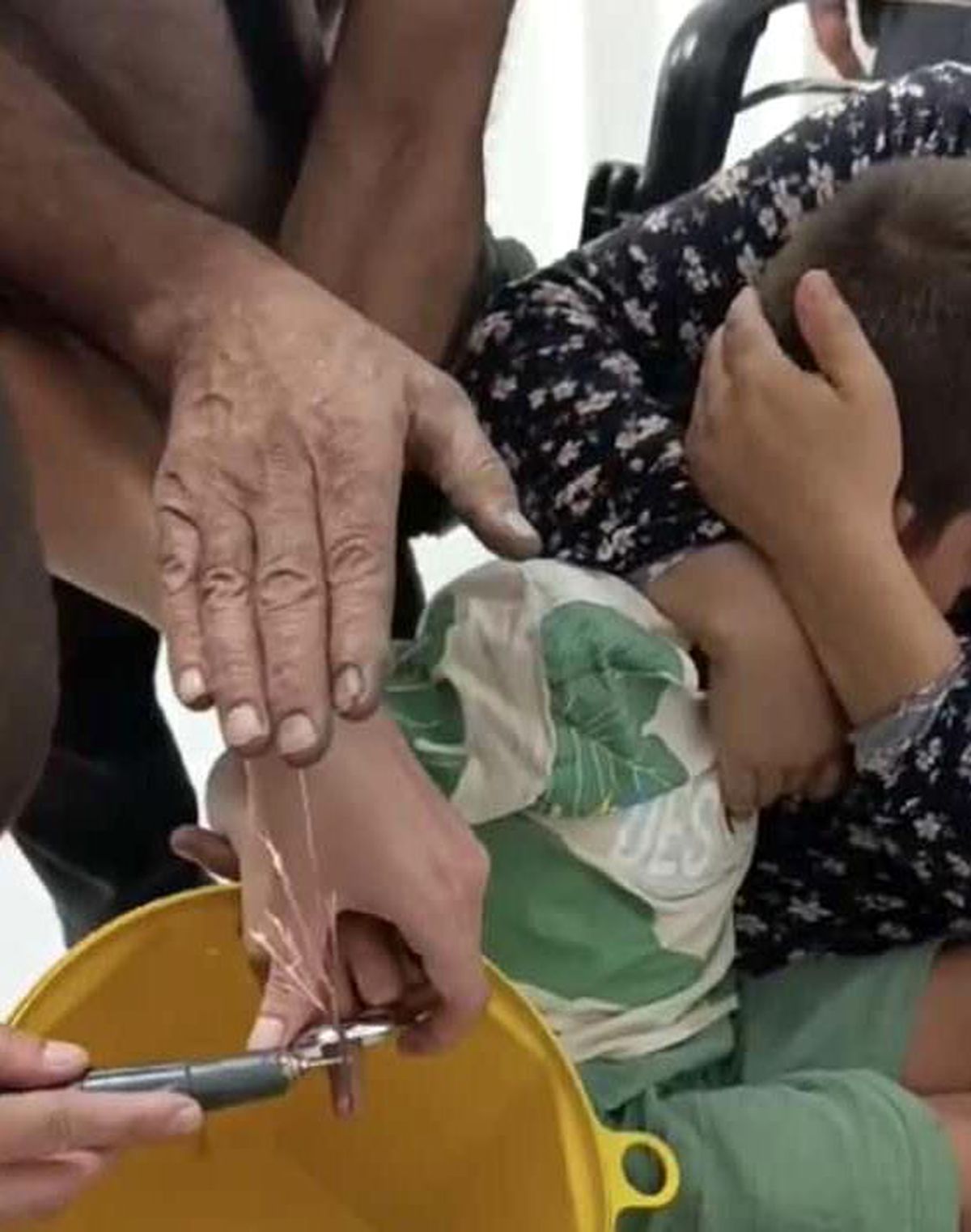 Osmaniye\'de Evde Oyun Oynayan Çocuğun Parmak Sıkışması