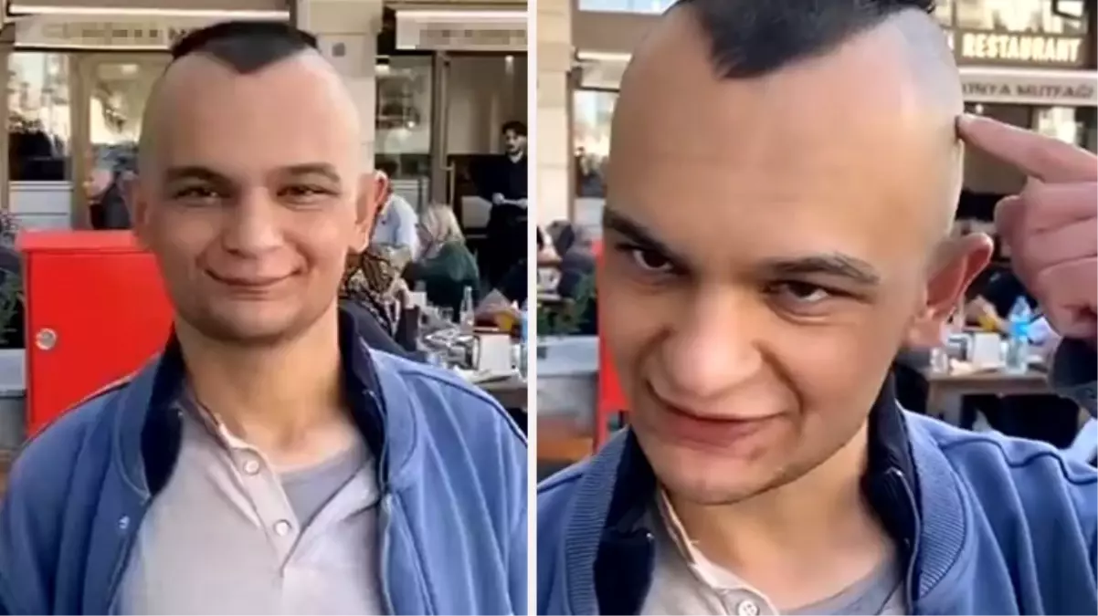 Zabıtalardan dayak yiyen dilenciden akılalmaz sözler: Altın bileziğimden vazgeçersem utanırım, ölümüne çıktım bu yola