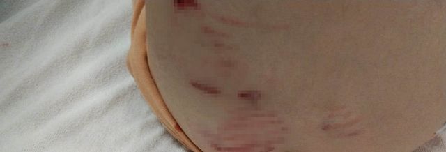 Ankara'da başıboş köpeklerin saldırısına uğrayan 5 yaşındaki çocuk hastanelik oldu Ankara'da başıboş köpeklerin saldırısına uğrayan 5 yaşındaki çocuk hastanelik oldu