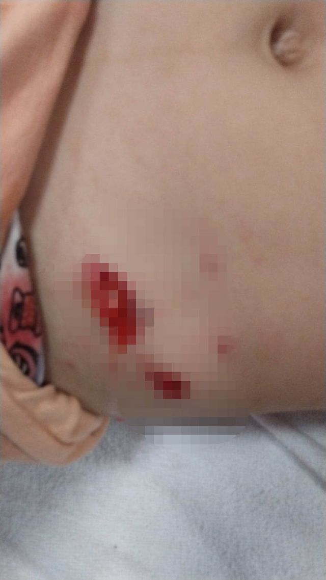 Ankara'da başıboş köpeklerin saldırısına uğrayan 5 yaşındaki çocuk hastanelik oldu Ankara'da başıboş köpeklerin saldırısına uğrayan 5 yaşındaki çocuk hastanelik oldu