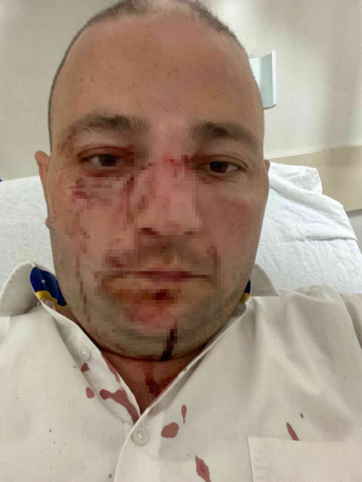 Bu nasıl öfke! Otobüsün farından rahatsız olan baba-oğul, şoförü darp etti Bu nasıl öfke! Otobüsün farından rahatsız olan baba-oğul, şoförü darp etti