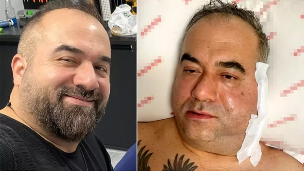 Ameliyatta ölümle ilgili korkunç iddia! \'\'Doktor bey hasta çok kötü\'\'