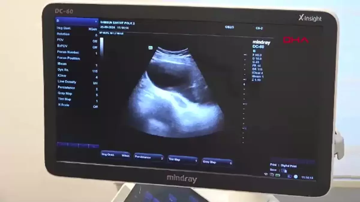 Samsun\'da ÜYTE Merkezi 300 Aileyi Sevindirdi