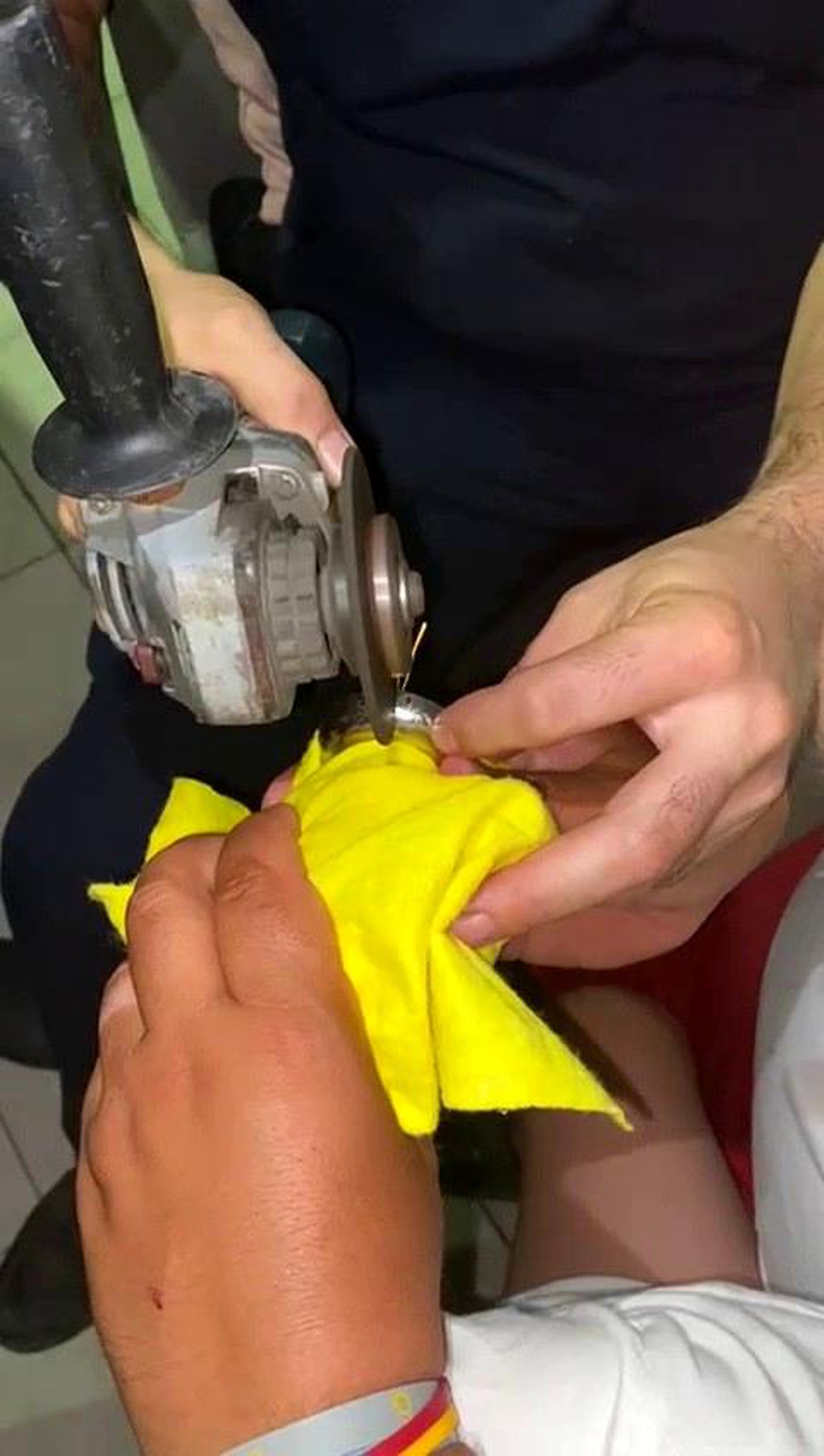 Hatay\'da Çocuğun Parmağı Musluk Rozetine Sıkıştı