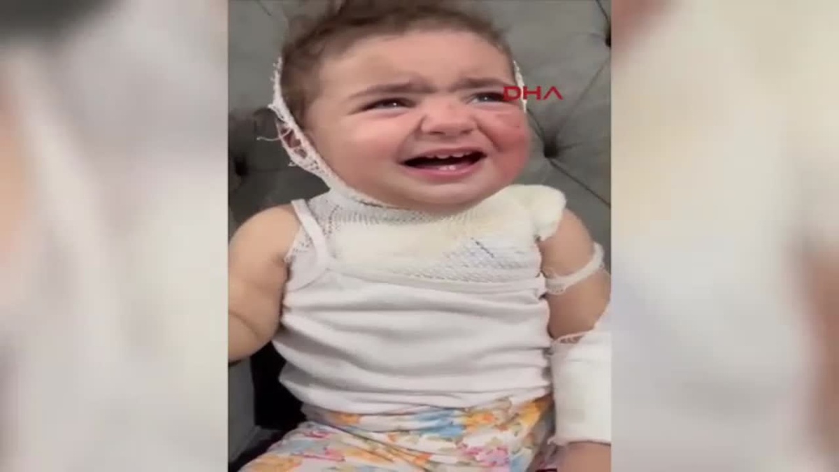 Kreşte Kahve Yangını: 1,5 Yaşındaki Çocuk Yandı