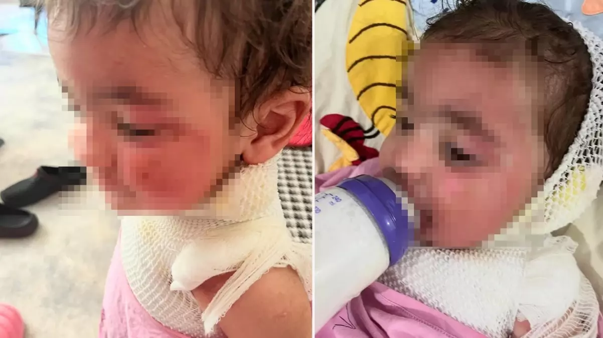 Kreşte \'\'kahve\'\' faciası! Sapasağlam bıraktığı bebeğini, yanıklarla teslim aldı