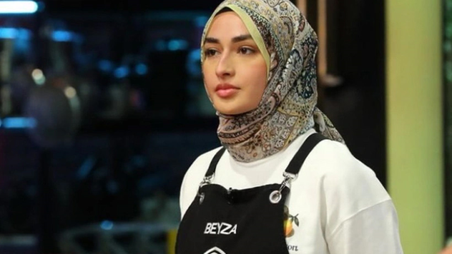 Masterchef'te yüzü yanan Beyza'nın son hali