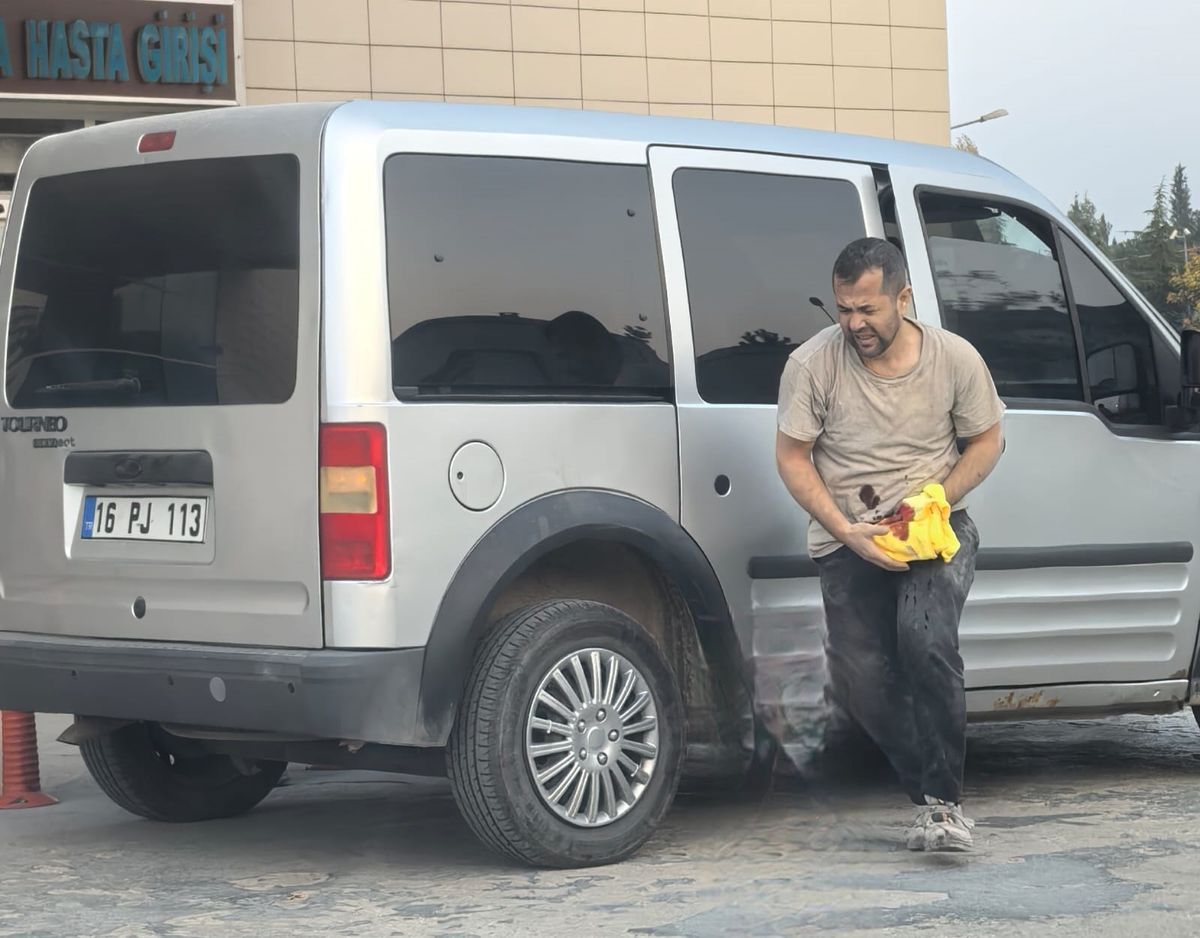 Odun Kesimi Sırasında Kaza: Sol El Parçalandı