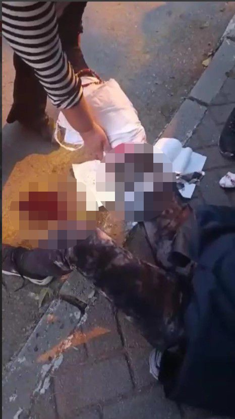Ankara'da başıboş köpek vahşeti: Kadın akademisyenin yüzü ve bacağı parçalandı Ankara'da başıboş köpek vahşeti: Kadın akademisyenin yüzü ve bacağı parçalandı