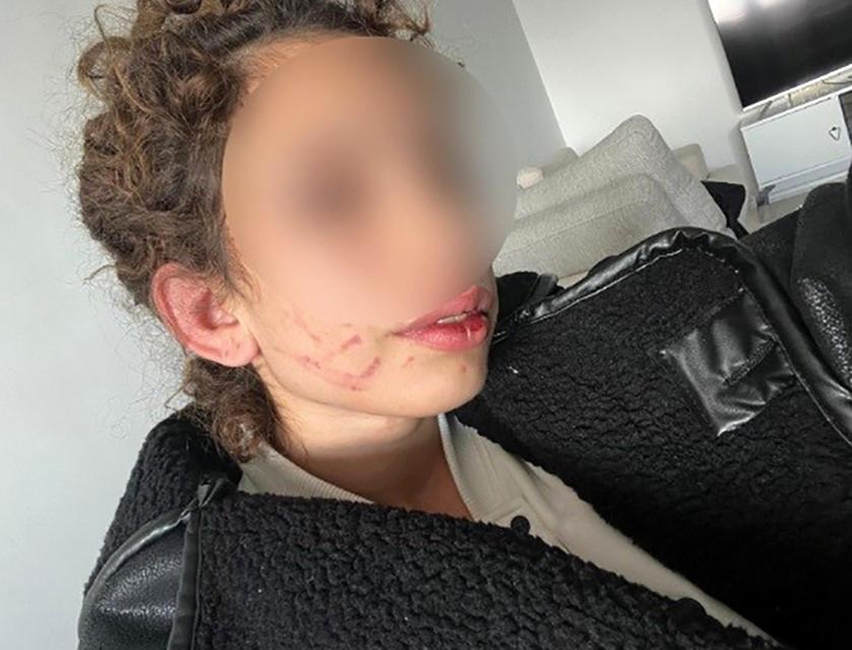 Darp Skandalı: Üniversite Öğrencisine Şiddet