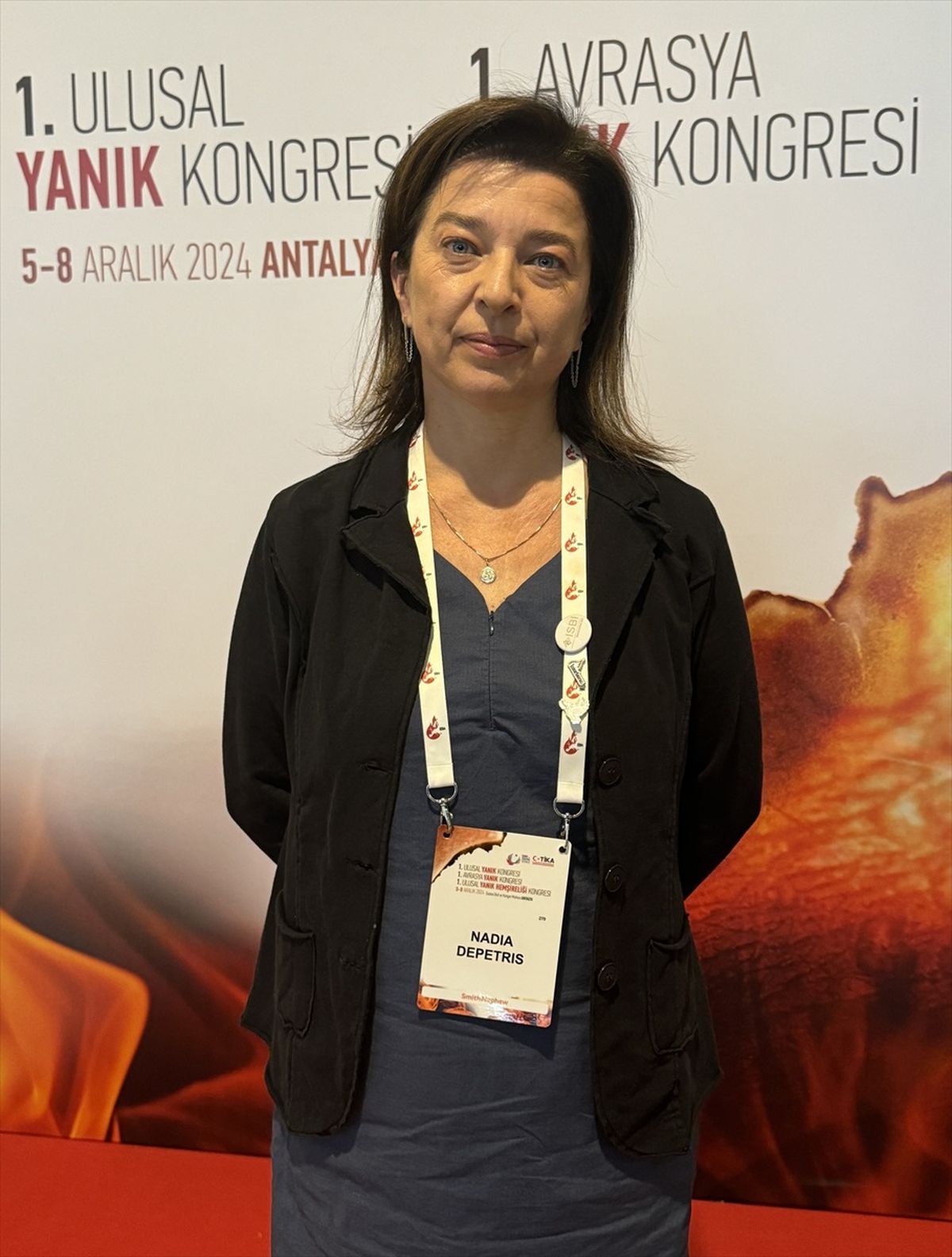 Türkiye Yanık Tedavisinde Referans Ülke