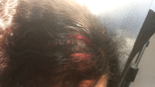 Ankara'da Saplantılı Komşu Korkusu: Kadın ve Çocukları Hayatlarını Kaybetme Tehdidi Altında