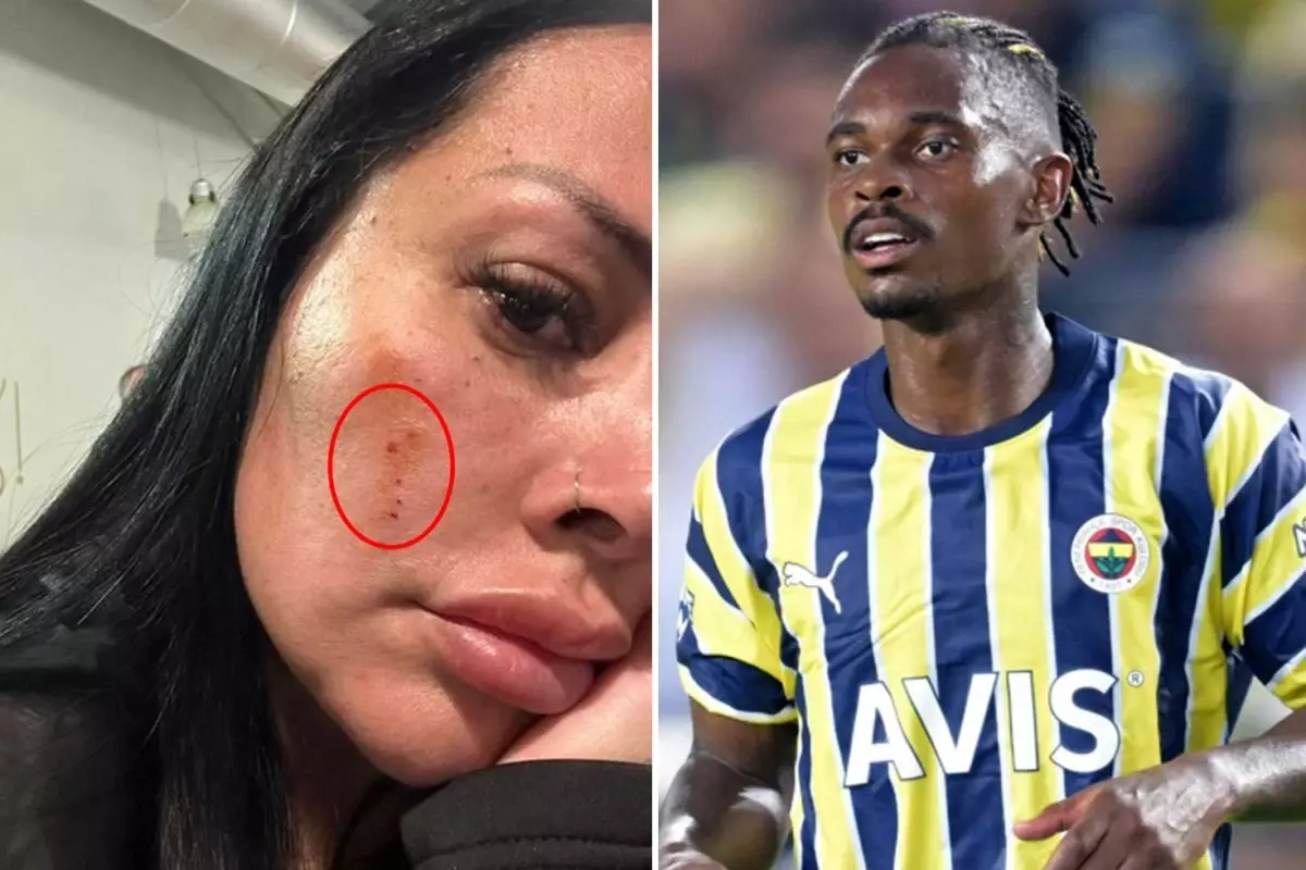 Fenerbahçeli Lincoln Henrique\'nin eşi Adriana Müller, sokak ortasında saldırıya uğradı