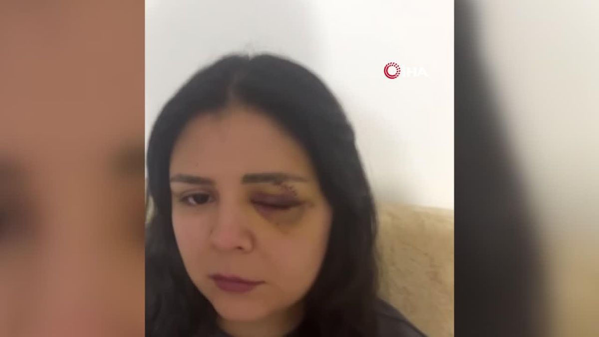 Saldırıya Uğrayan Genç Kızın Korku Dolu Anları