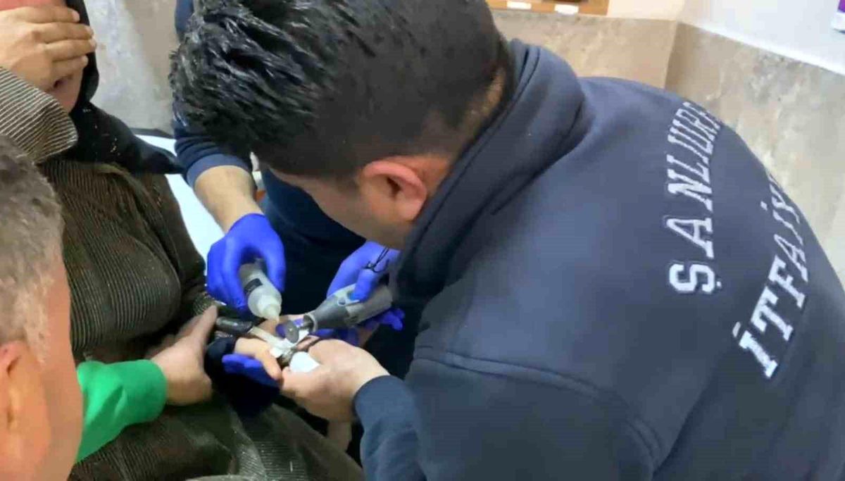 Şanlıurfa\'da Yüzük Sıkışan Kadının İmdadına İtfaiye Yetişti