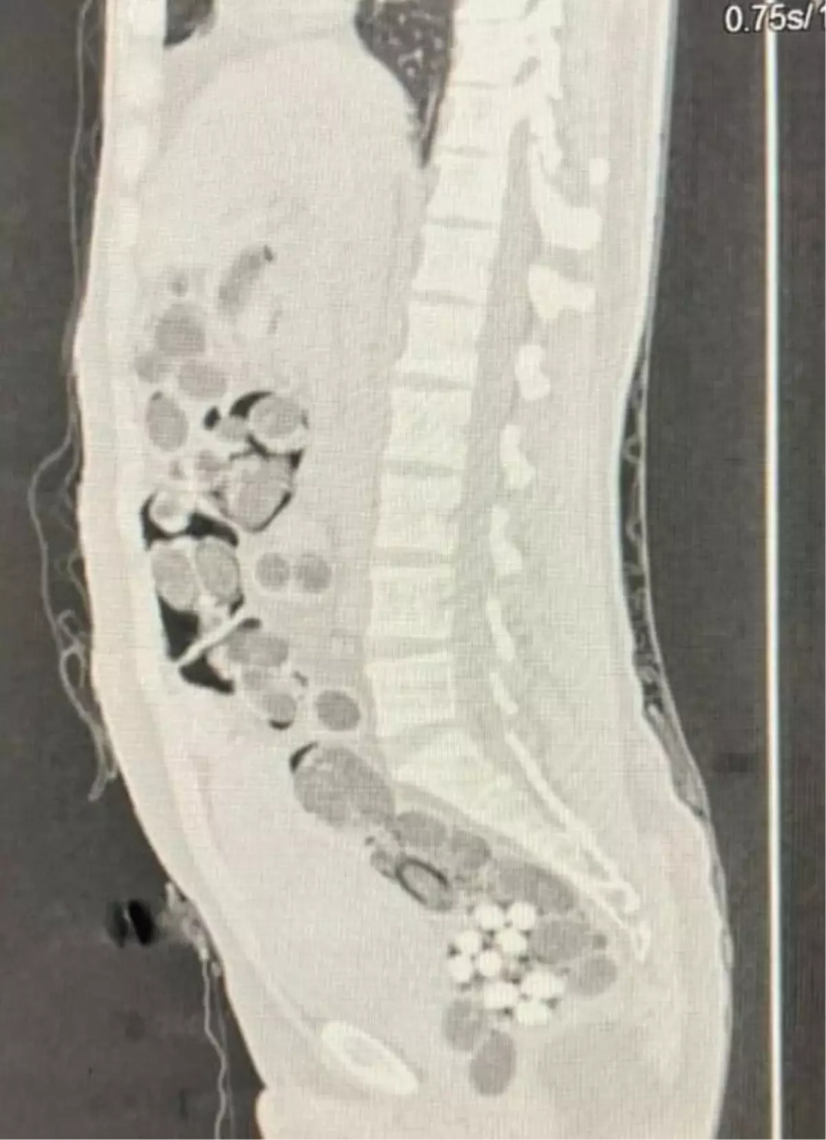 Denizli\'de Uçakta Uyuşturucu Taşıyan Yabancı Uyruklu Yolcu Yakalandı