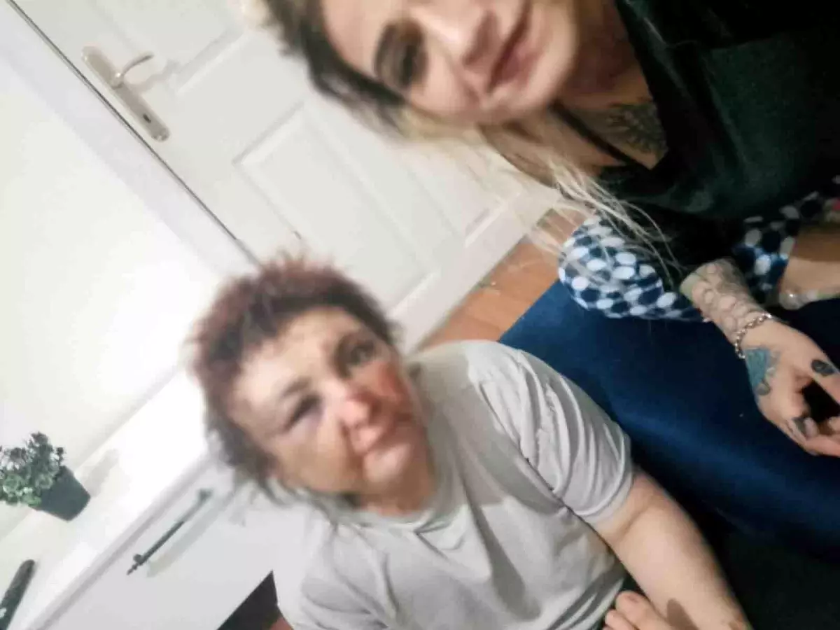 Ankara\'da Zorla Alıkoyma ve Darbetme Olayı: İki Şüpheli Tutuklandı