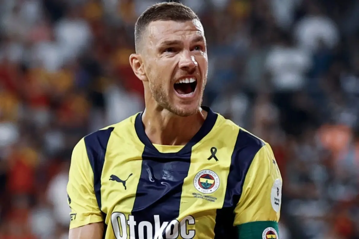 Edin Dzeko\'nun elinde kırık tespit edildi