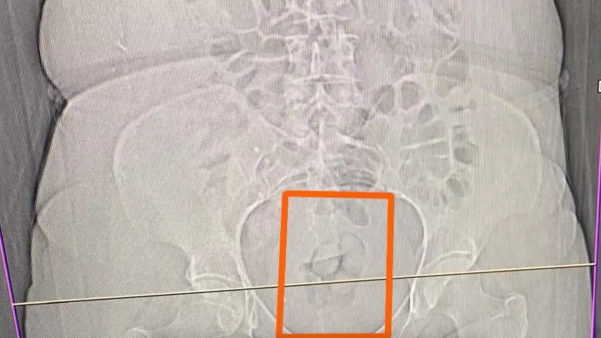 Erzincan\'da Uyuşturucu Ticareti Operasyonu: 4 Şüpheli Yakalandı