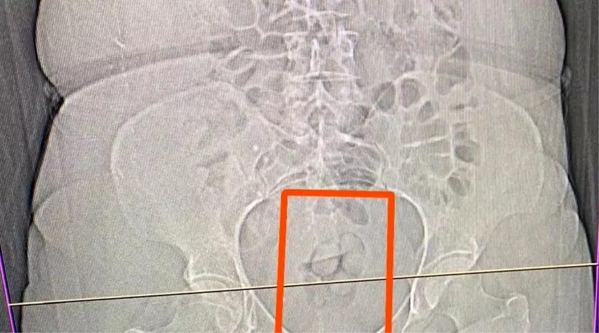 Erzincan\'da Uyuşturucu Operasyonu