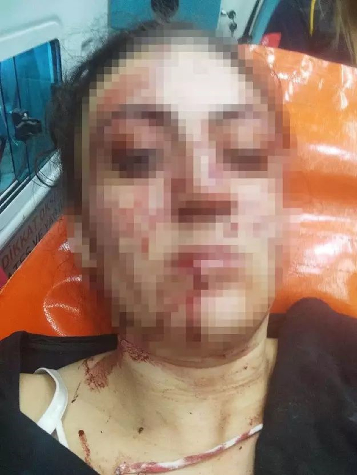 Sinem\'i 7 yerinden bıçaklayan eski eşine indirimli hapis cezasının gerekçesi: Hakaret etti