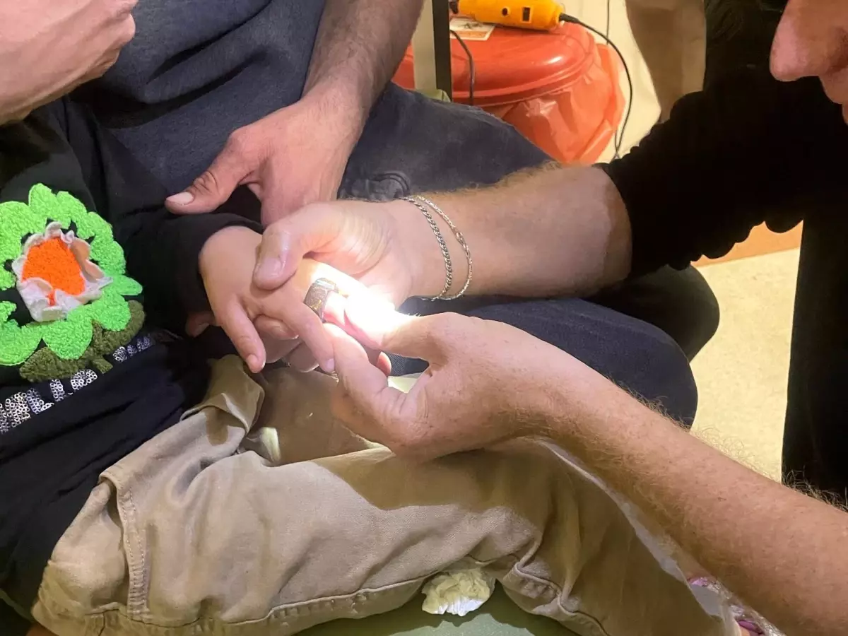 Siirt\'te Çocuğun Parmağındaki Somun Çıkarıldı