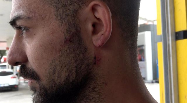 Kavgayı ayırmak isteyen esnafın kulağını ısırdı