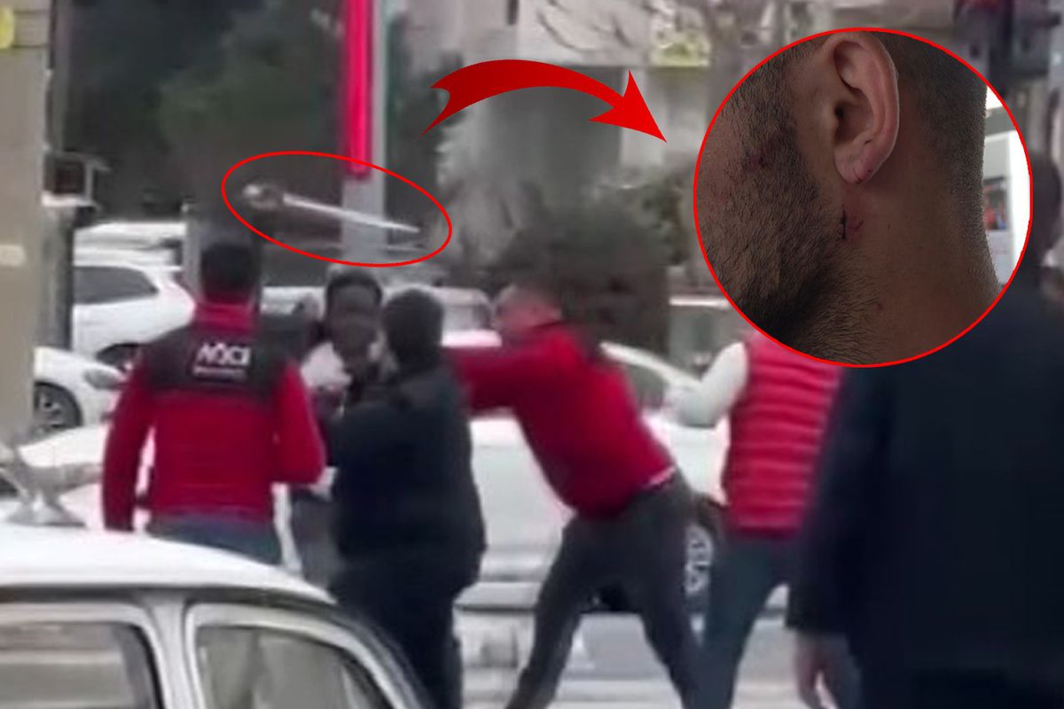 Kavgayı ayırmak isteyen esnafın kulağını ısırdı