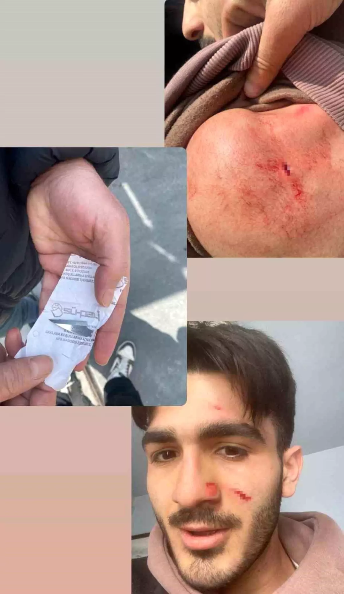 Esenyurt\'ta Milli Sporcunun Saldırıya Uğraması