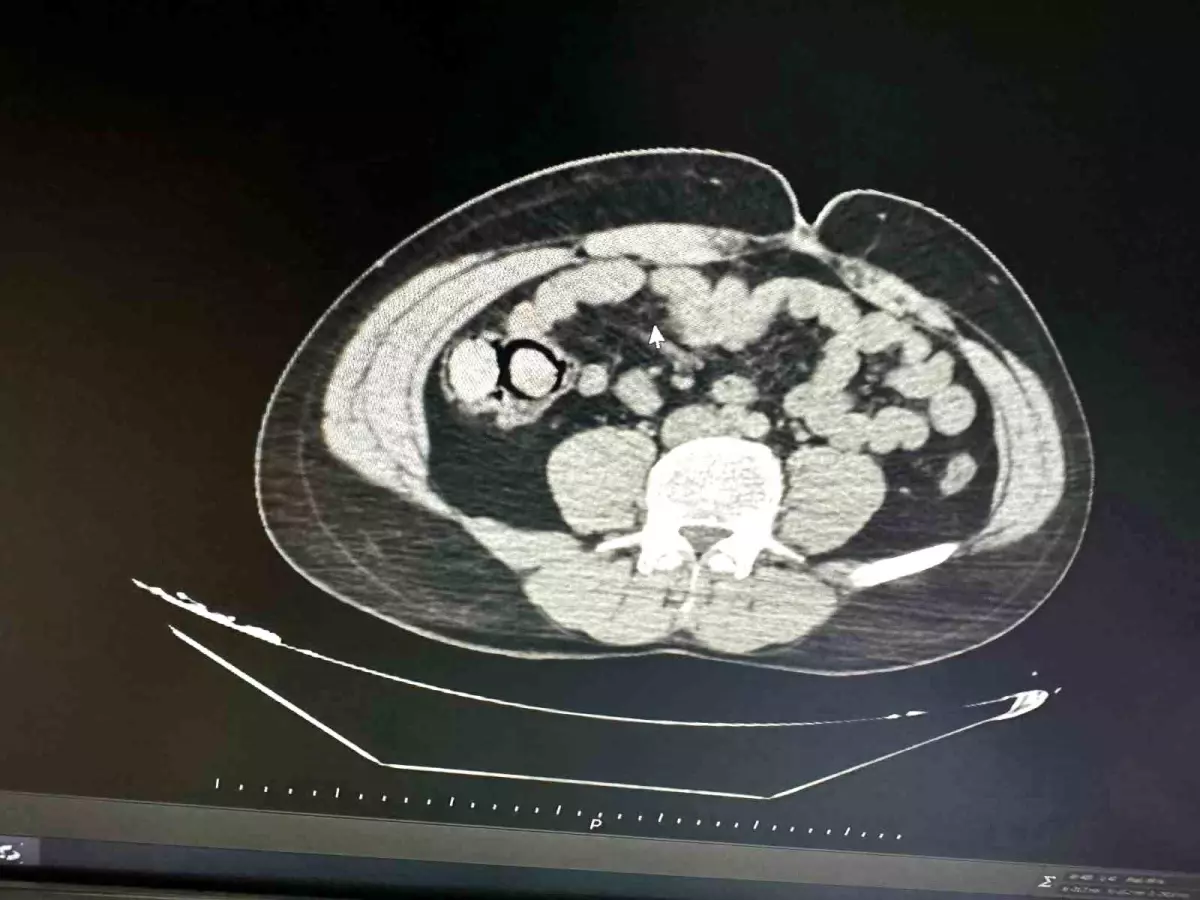 Bingöl\'de Uyuşturucu Kaçakçılığı