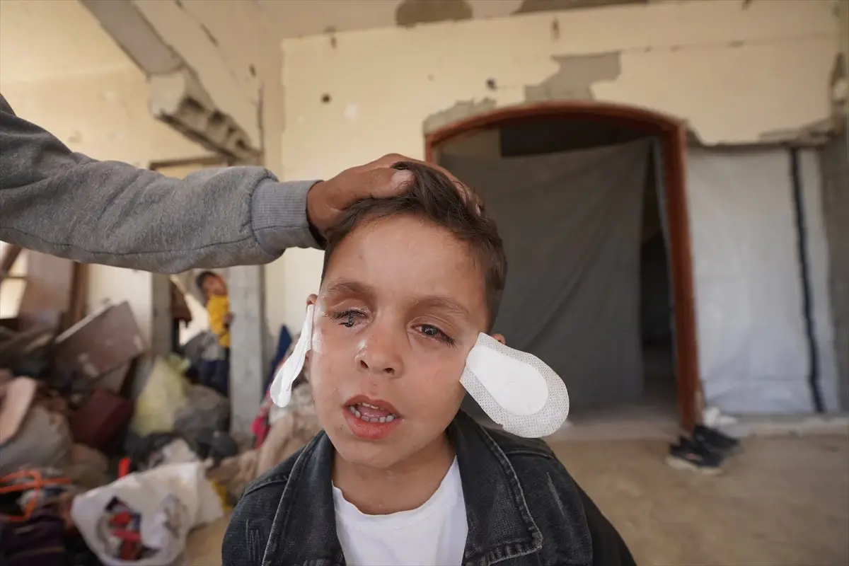 Filistinli Çocuk Mühimmat Patlamasında Gözünü Kaybetti