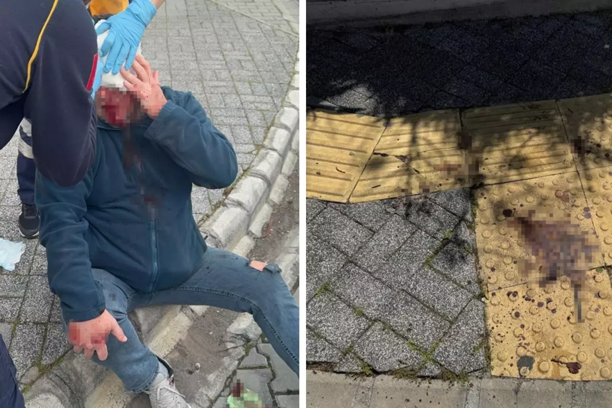 Marmaris\'te gazeteciye saldırı da 5 kişi gözaltına alındı